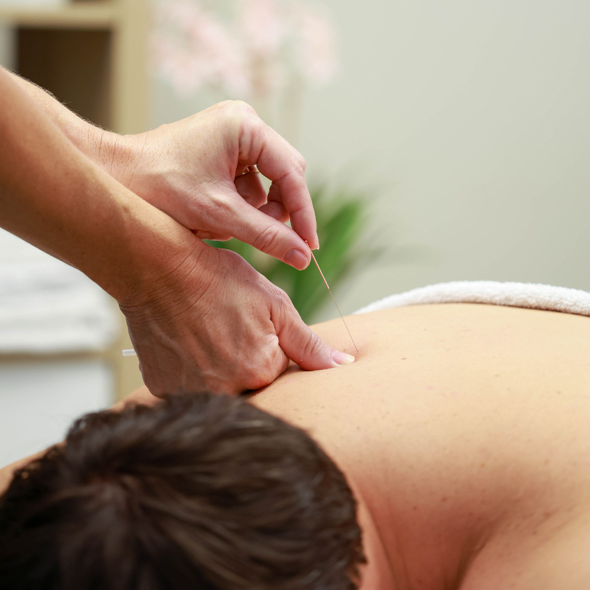dry needles in persons shoulder
