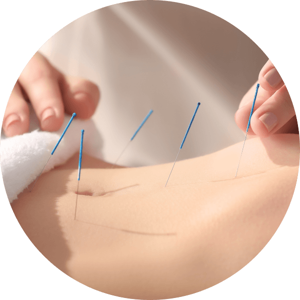 img-services-acupuncture