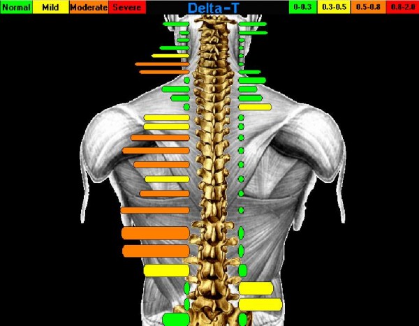 State of the art diagnostics at Brisbin Family Chiropractic