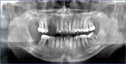 Dental X-ray Dracut