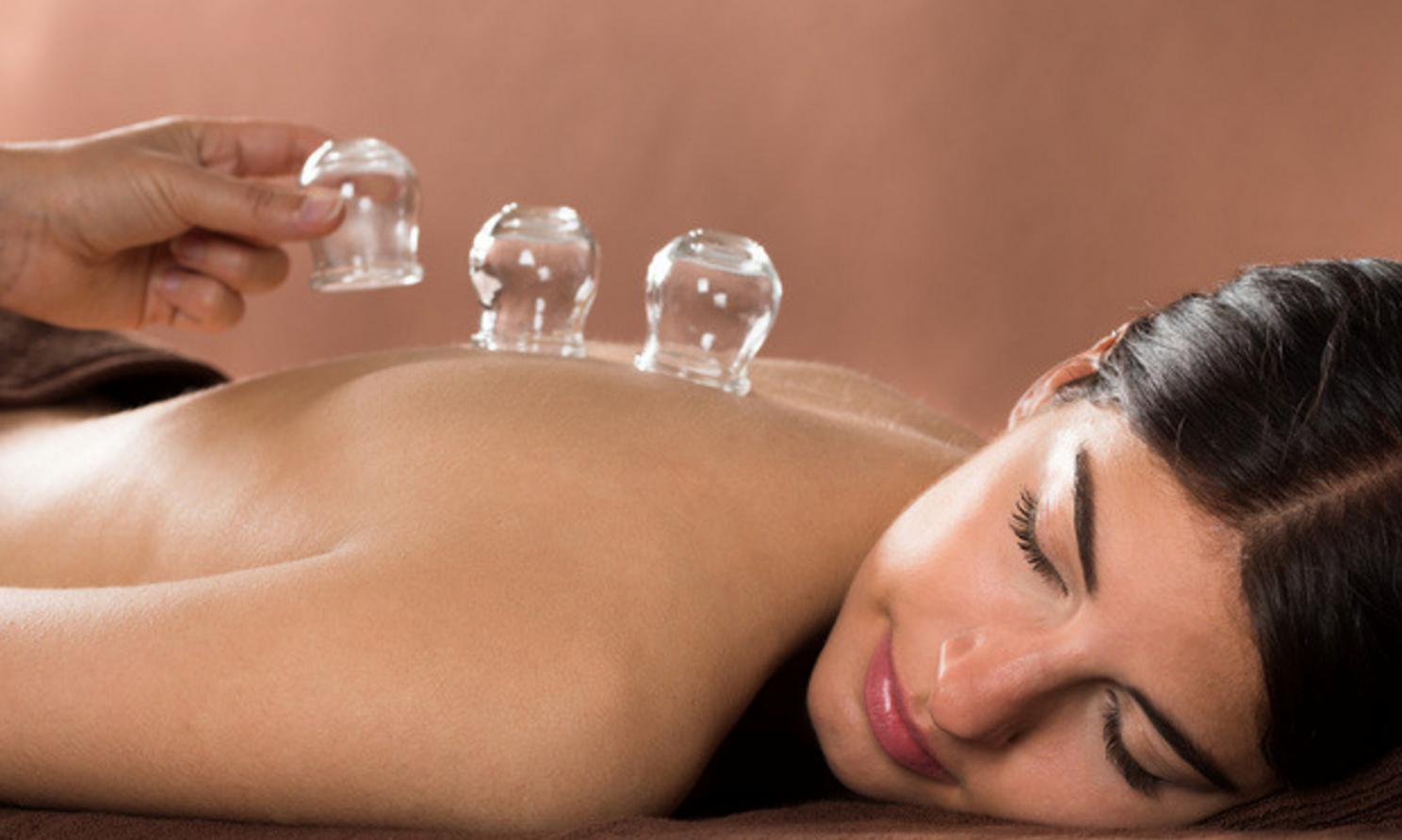 Cupping-Spa