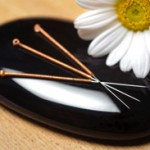 Newark Acupuncture