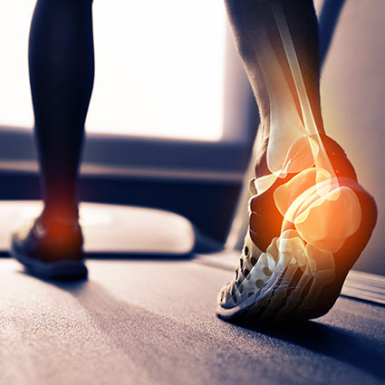 Put Your Feet Up & Learn More About Plantar Fasciitis - Middletown Health &  Wellness Center