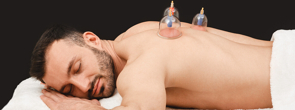 Relaxed patient being treated with cupping therapy
