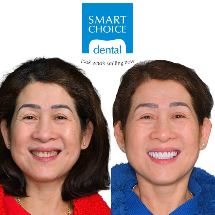 Before and after gallery 4