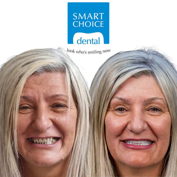 Before and after gallery 1