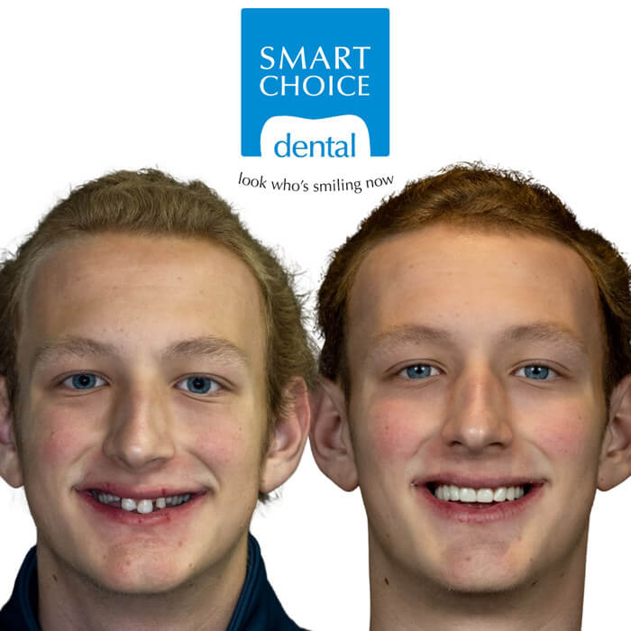 Before and after gallery 2