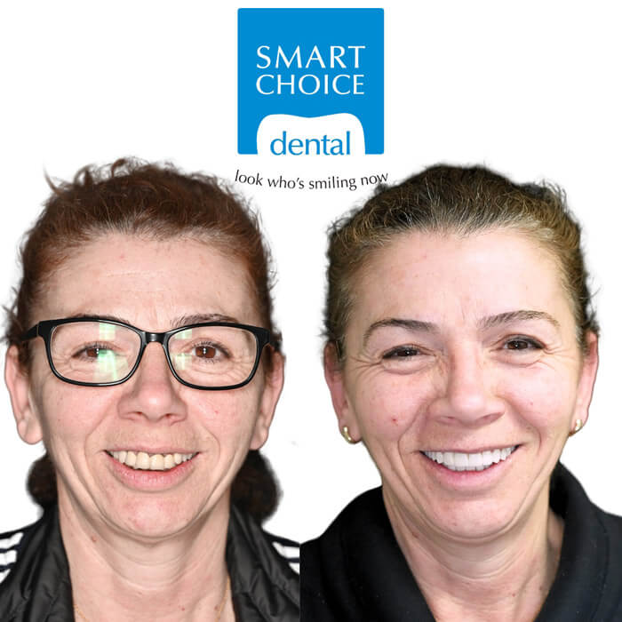 Before and after gallery 3