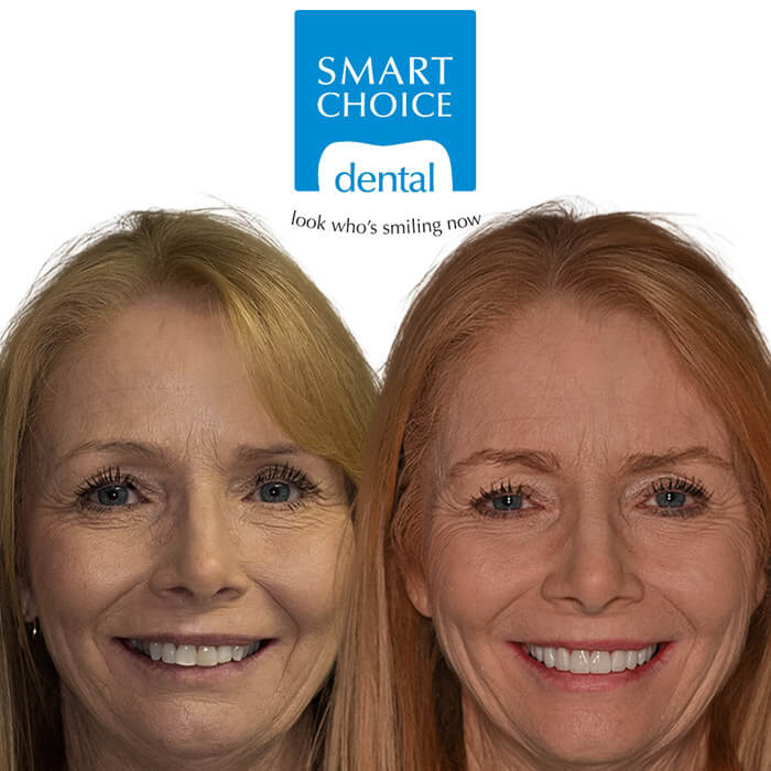 Before and after gallery 5