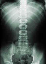 x-rays are sometimes used at Waterford’s “Top” Chiropractor