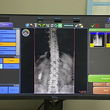X-ray on computer screen