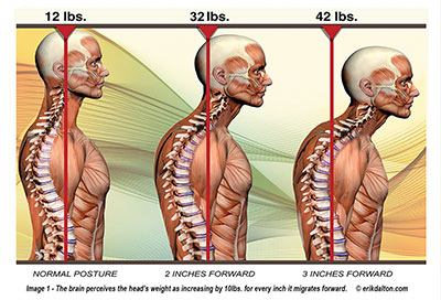 Tips to prevent 'tech neck' and other pain from technology use