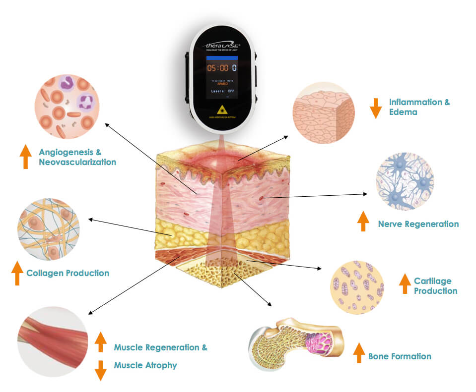 LLLT-Effects-TLC2000 copy
