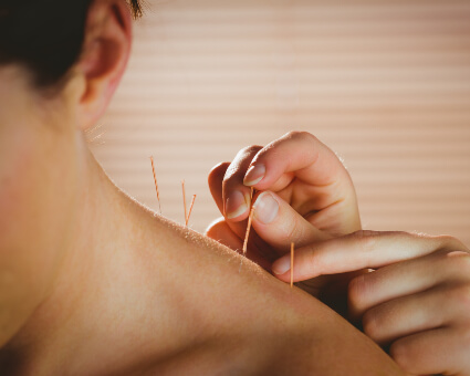 Western medical acupuncture female patient