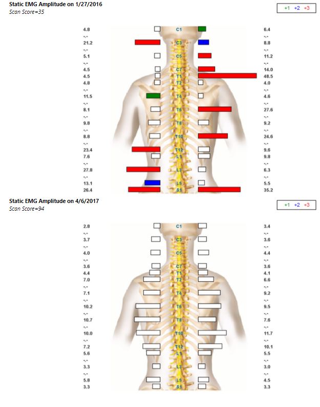 EMG scan