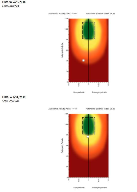 HRV scan