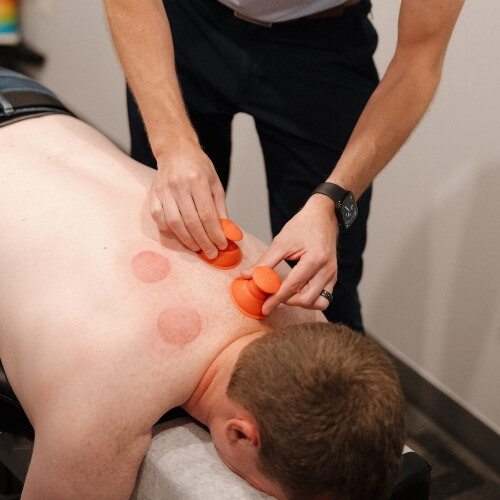 Patient treated with cupping therapy