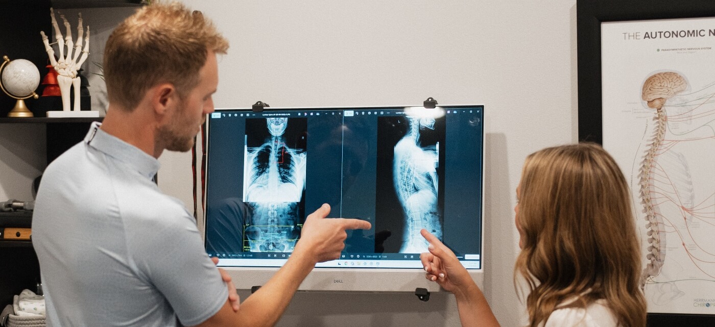 Chiropractor pointing at x-ray