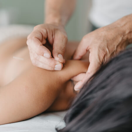 Female patient treated with acupuncture