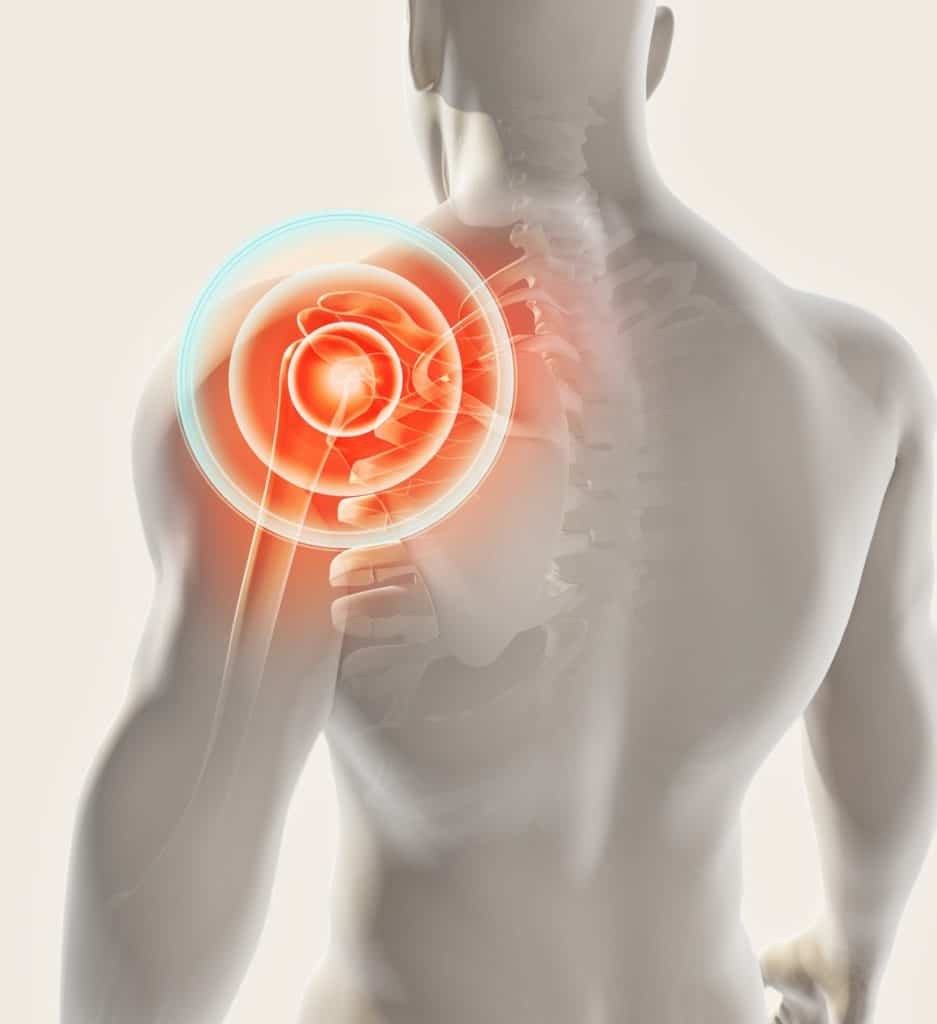 Shoulder-pain-radiating-Littlehampton-Chiropractor-Osteopath-Sussex