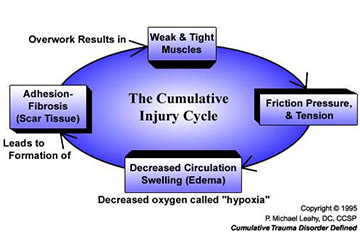 Cumulative injury cycle graphic
