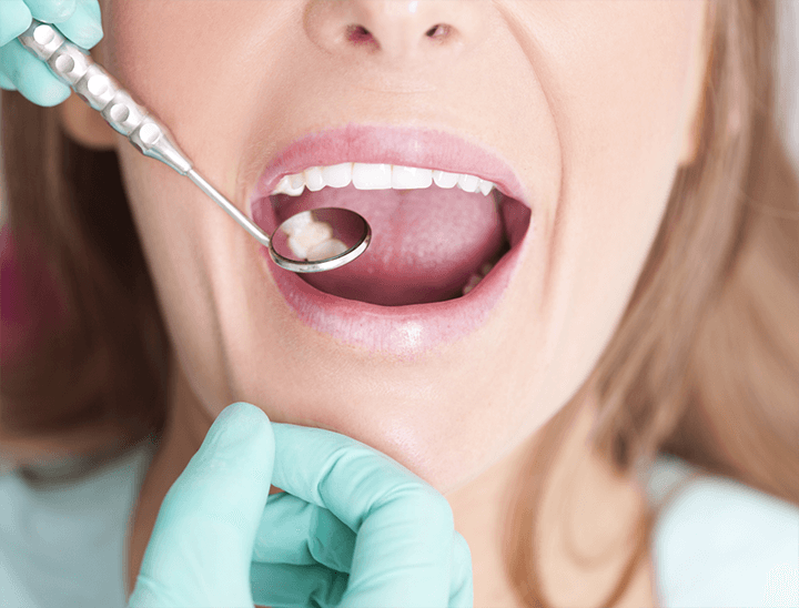 Dental Check-up