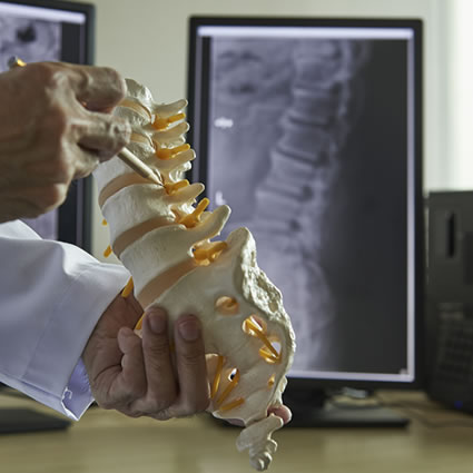 spine model xray at the background