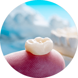 Dental crown sitting on a finger