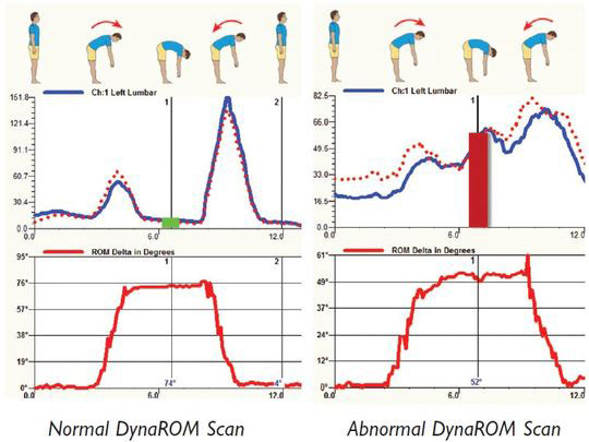 DynaRom Scan Chart