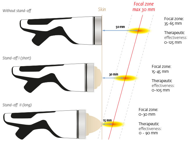 How Shock Therapy Works