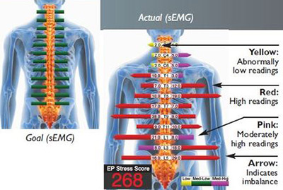 emg test pain medication