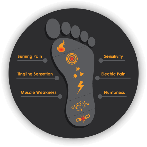 Neuropathy Foot Diagram