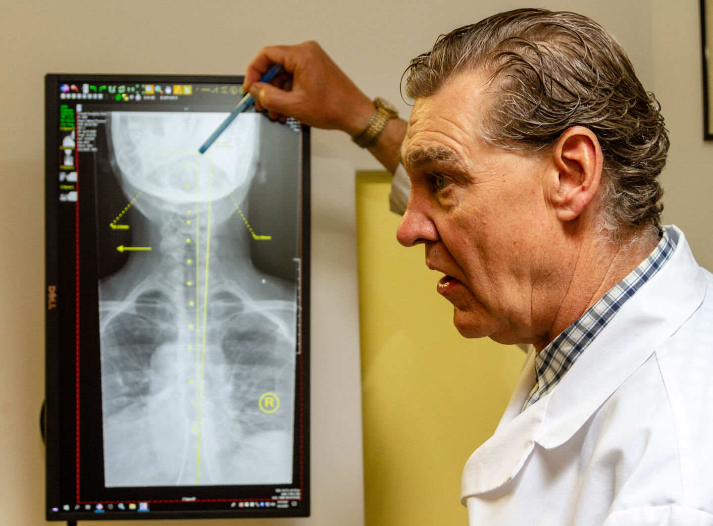 woman with neck pain after auto accident