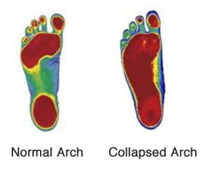 Foot scans