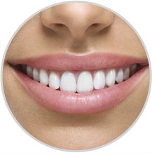 Cosmetic Dentist Strathfield