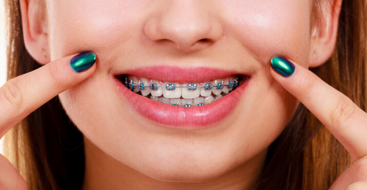 img-traditional-metal