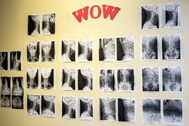 The WOW board at Back and Neck Specialists.