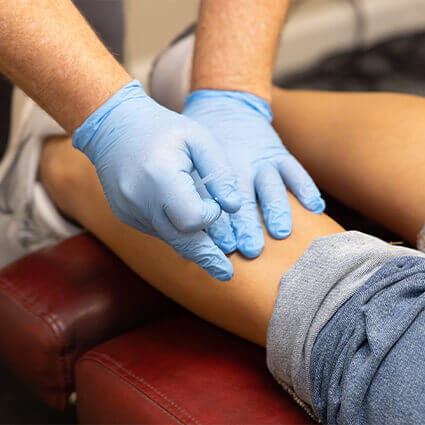 Applying dry needle technique to leg