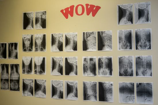 X-ray board
