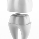 dental-crowns-150x150
