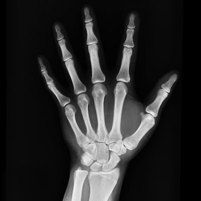 High-resolution X-ray capturing the bones of a human hand, displaying skeletal anatomy.