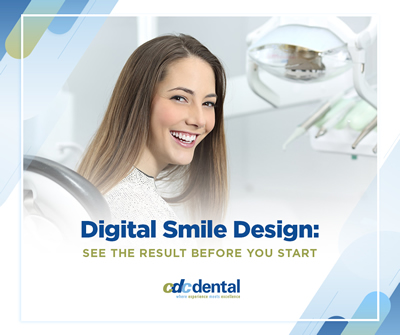 Digital smile design graphic