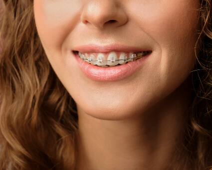 Woman wearing braces