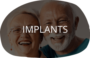 Implants