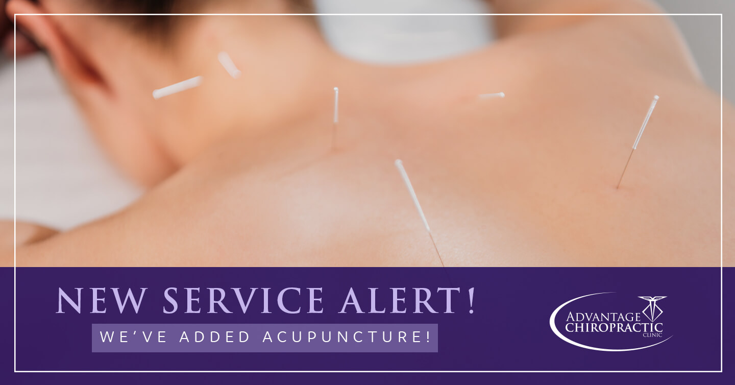 acupuncture