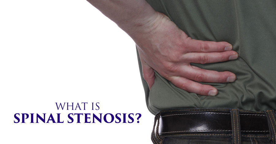 9--What-is-Spinal-Stenosis-
