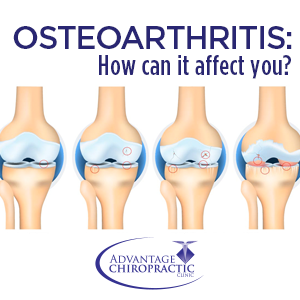 Osteoarthritis