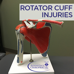 RotatorCuff