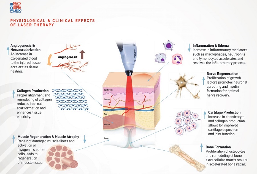 laser-therapy-pic5
