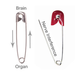 Nerve interference graphic